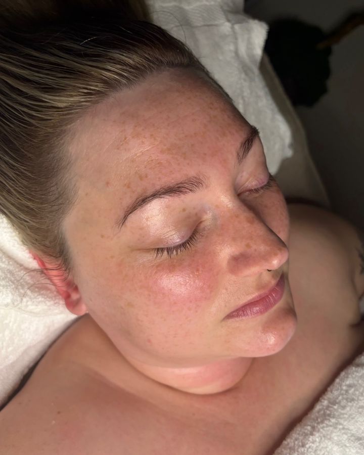 Client after a facial