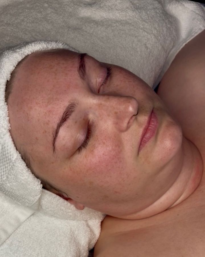 Client before a facial