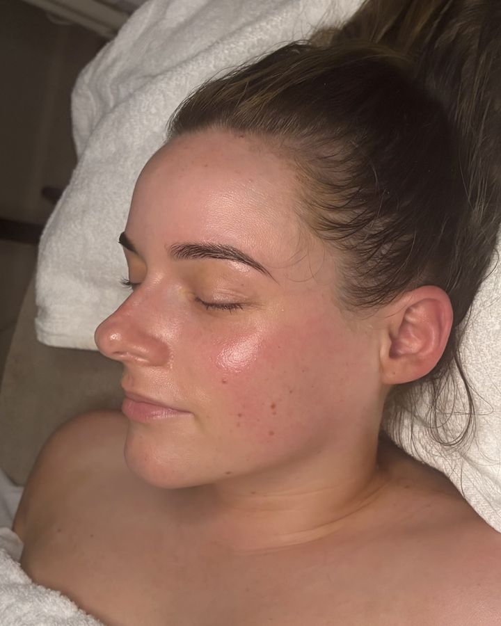 Client after a facial