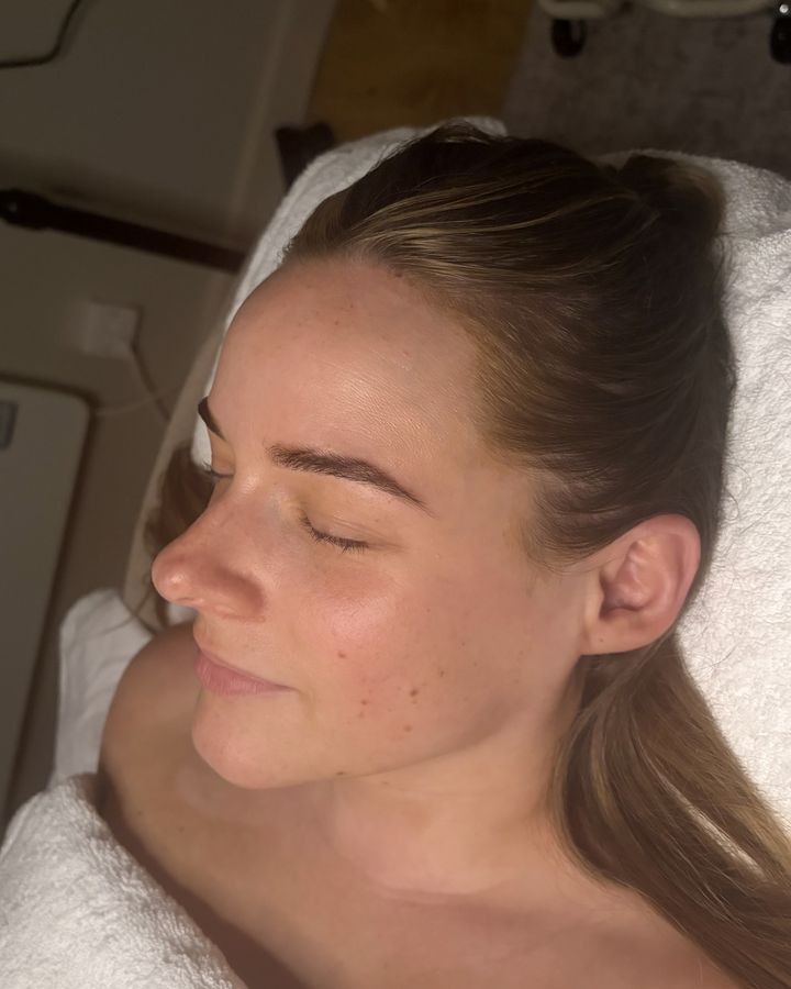 Client before a facial